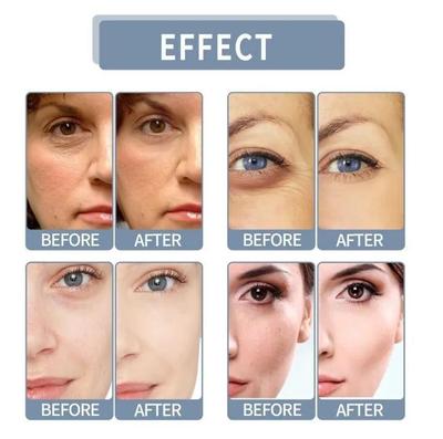 Skin Brightening Niacinamide Serum